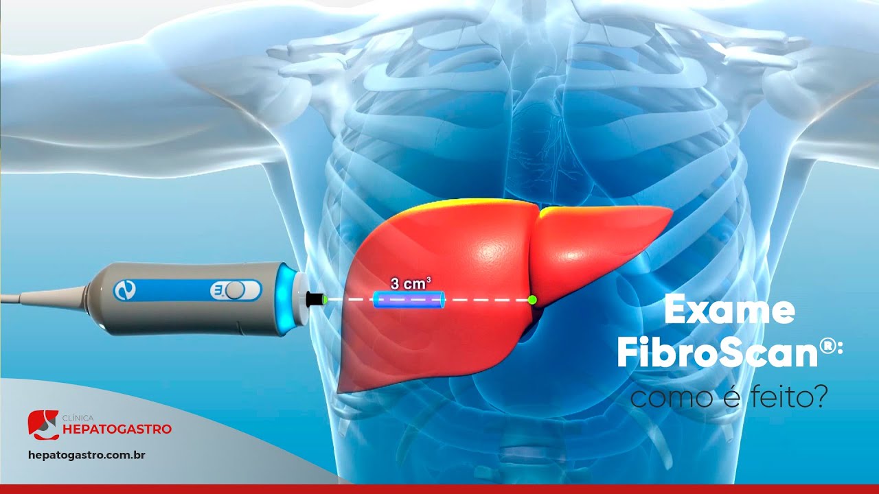Como &eacute; feito o exame FibroScan | Cl&iacute;nica Hepatogastro