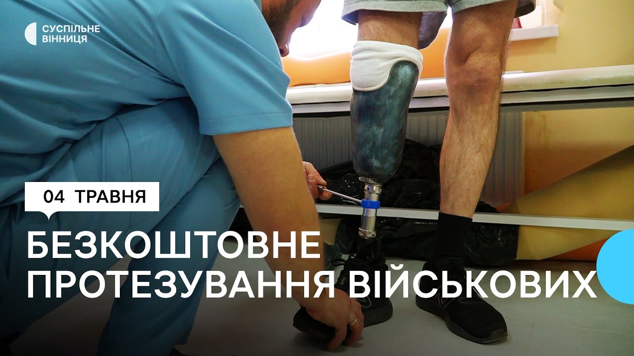 У Вінниці безкоштовно виготовляють протези для військових