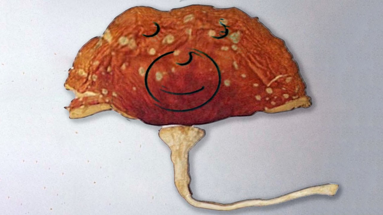 A Man Ate Forest-Picked Mushrooms And It Did Things To His Organs