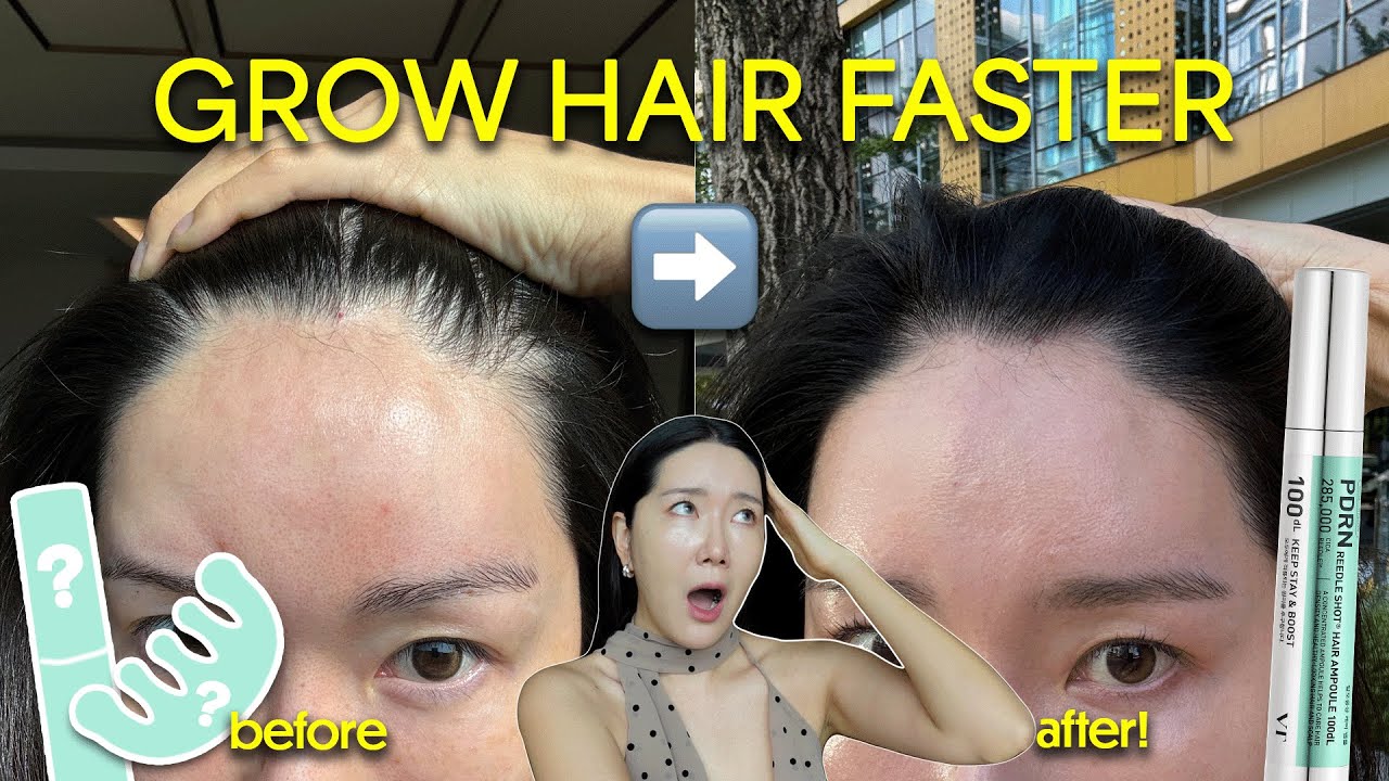 VIRAL Korean Hair Growth Product That Grows BABY HAIRS in 4-6 Weeks 🌱