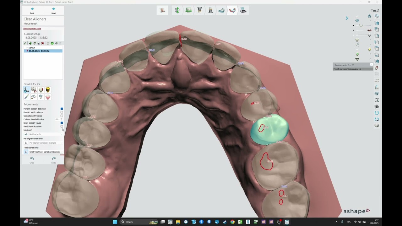 3Shape Ortho Analyzer - Виртуальный сетап