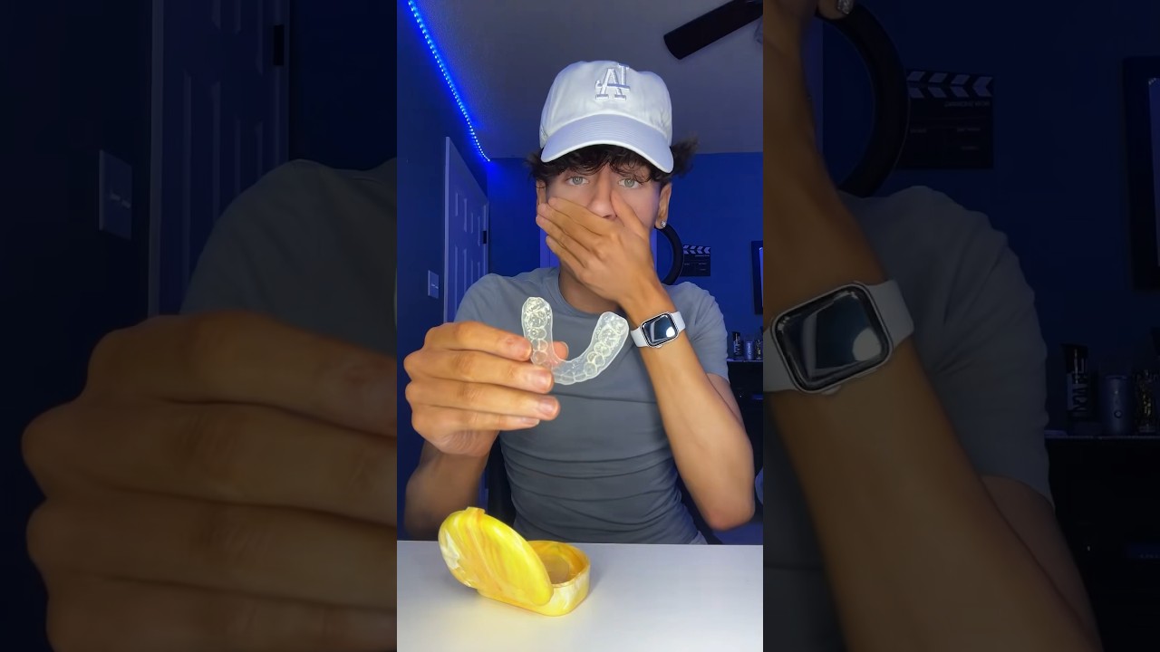 Nie nosił aparatu retencyjnego od 7 MIESIĘCY 😳🦷