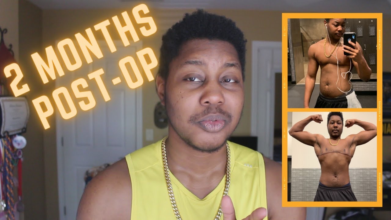 FTM Top Surgery Recovery: 2 Months Post Op | Double Incision | Scott Mosser