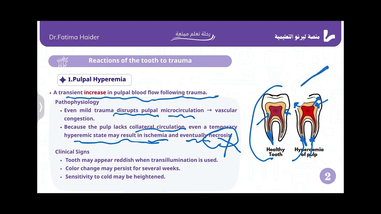بيدو مرحلة خامسة Reaction of the tooth to trauma /pedodontic