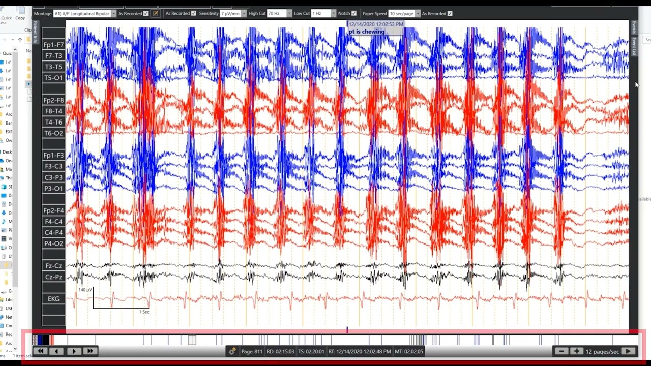 Arc Viewer: Reviewing an Exported Study - Arc 2.2