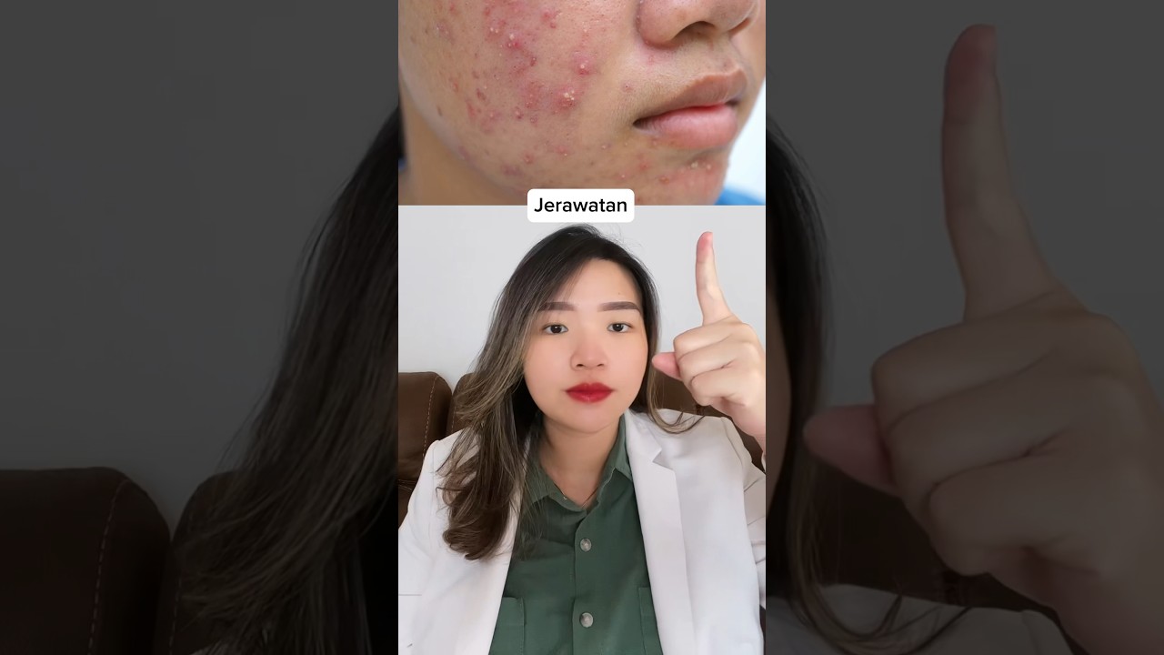 TIPS MENGATASI MASALAH KULIT SENSITIF, BERJERAWAT & BERUNTUSAN! #aestheticdoctor #skincaretips
