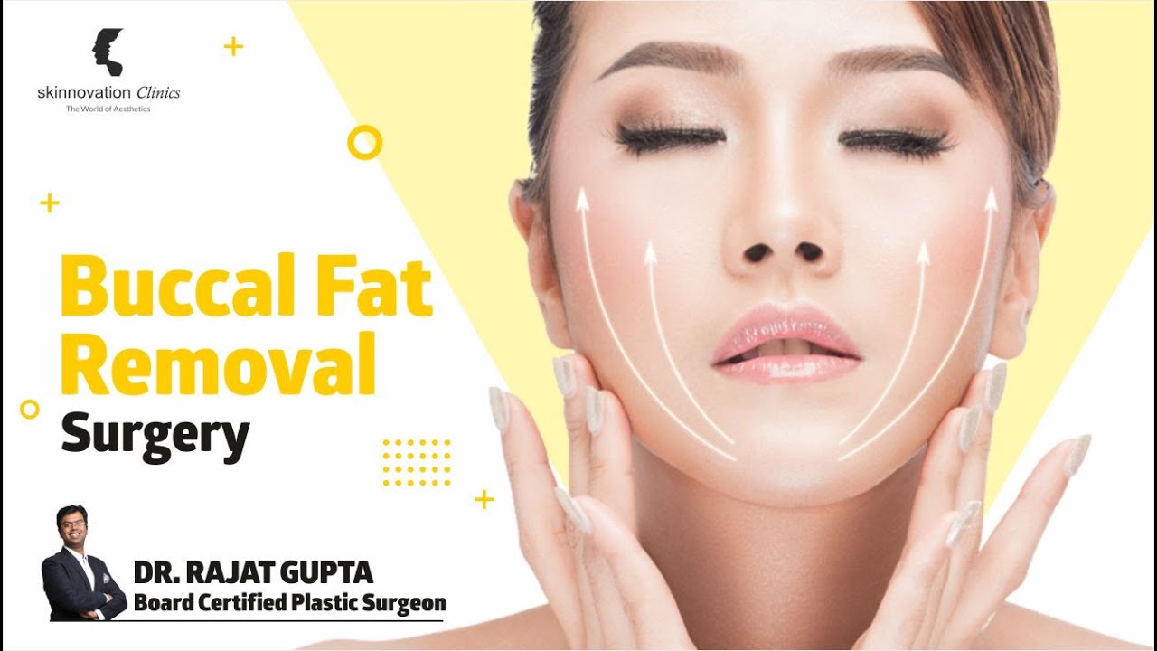 Buccal Fat Removal Surgery- Skinnovation Clinics - The World of Aesthetics