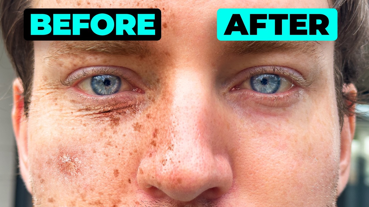 Treat the Signs of Skin Aging
