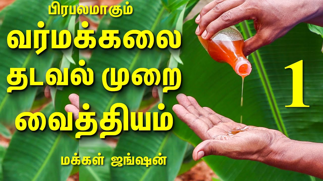 வர்மக்கலை தடவல் முறை வைத்தியம்|சுளுக்கு|VARMA THADAVAL MURAI VAITHIYAM|வர்மக்கலை சிகிச்சை|Varmakalai