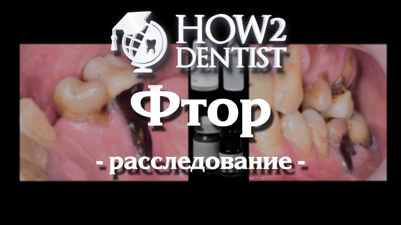 Как фтор работает против кариеса / How to Dentist