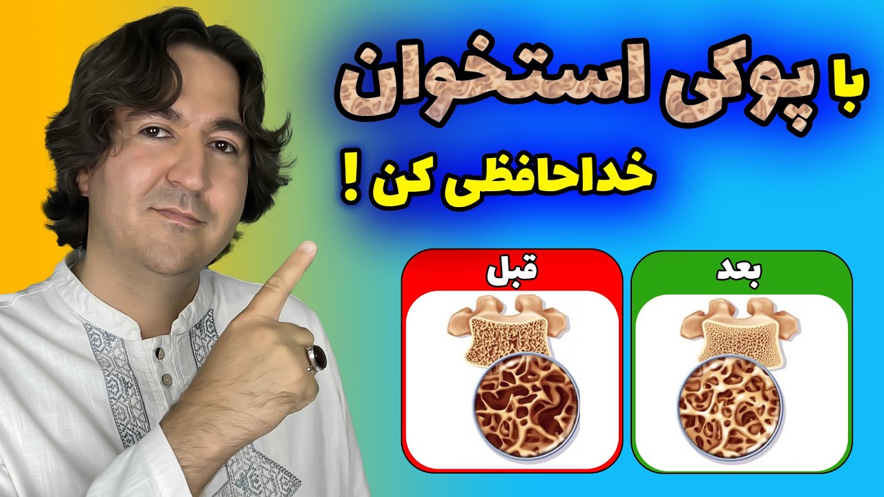 رازهایی که شما را از پوکی استخوان نجات میدهد! : درمان پوکی استخوان به روش کاملا طبیعی