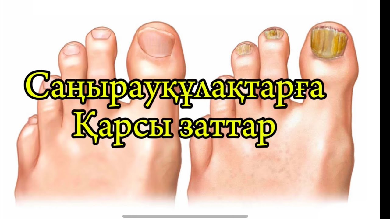 Саңырауқұлаққа қарсы препараттар