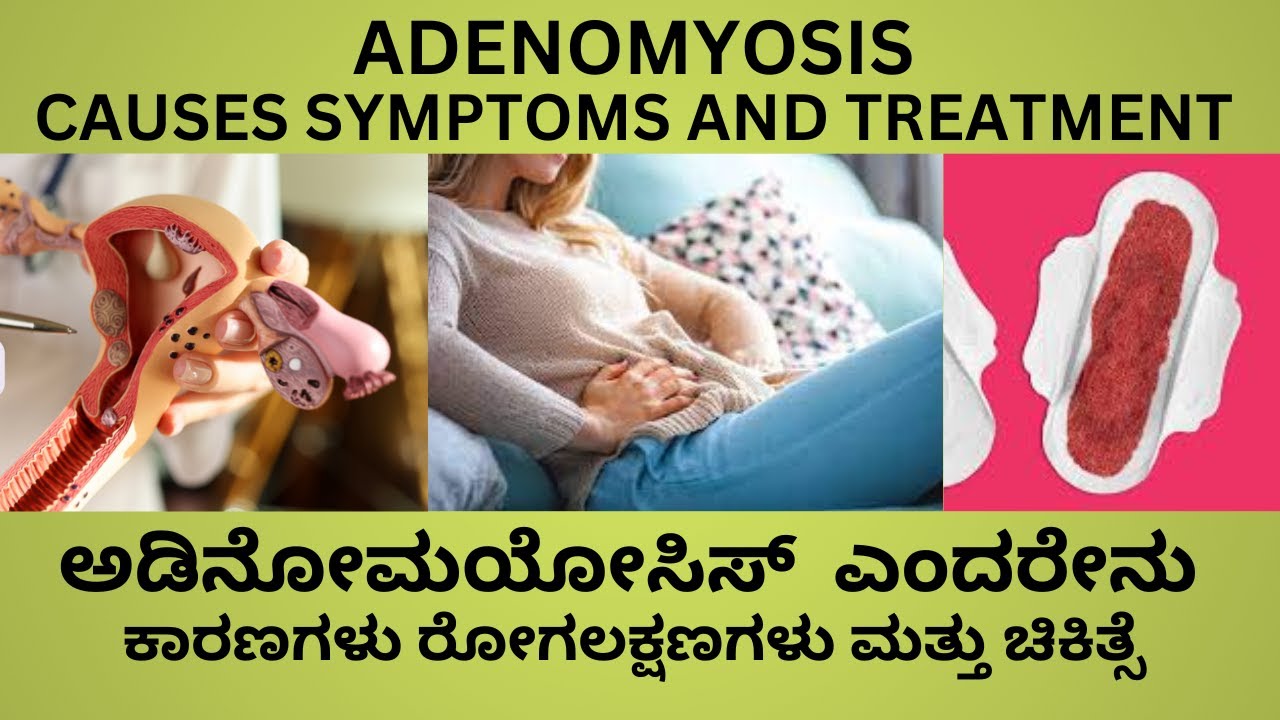 ADENOMYOSIS IN KANNADA.CAUSES SYMPTOMS DIAGNOSIS COMPLICATIONS ,TREATMENT OF ADENOMYOSIS IN KANNADA