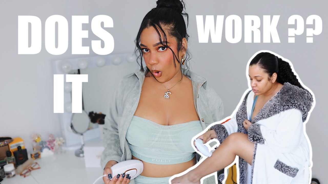 5 month LASER Hair Removal Update! Did it even work??