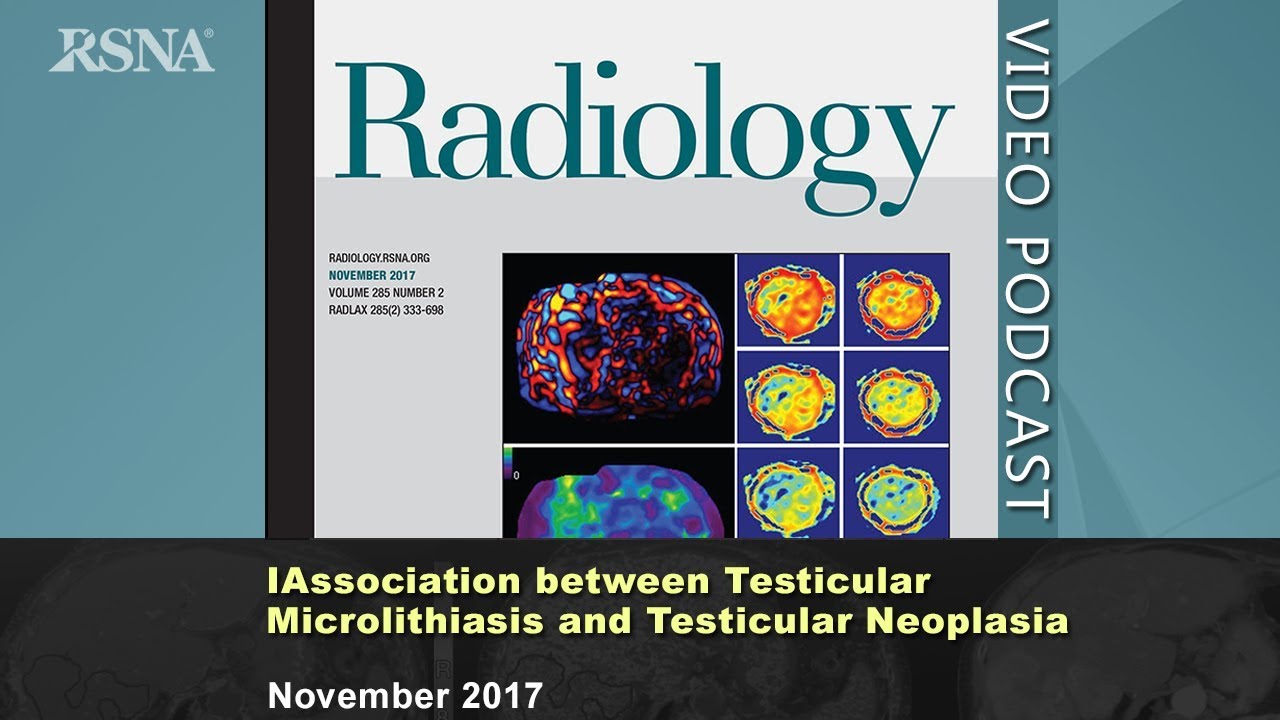 Association between Testicular Microlithiasis and Testicular Neoplasia (November 2017 Radiology)