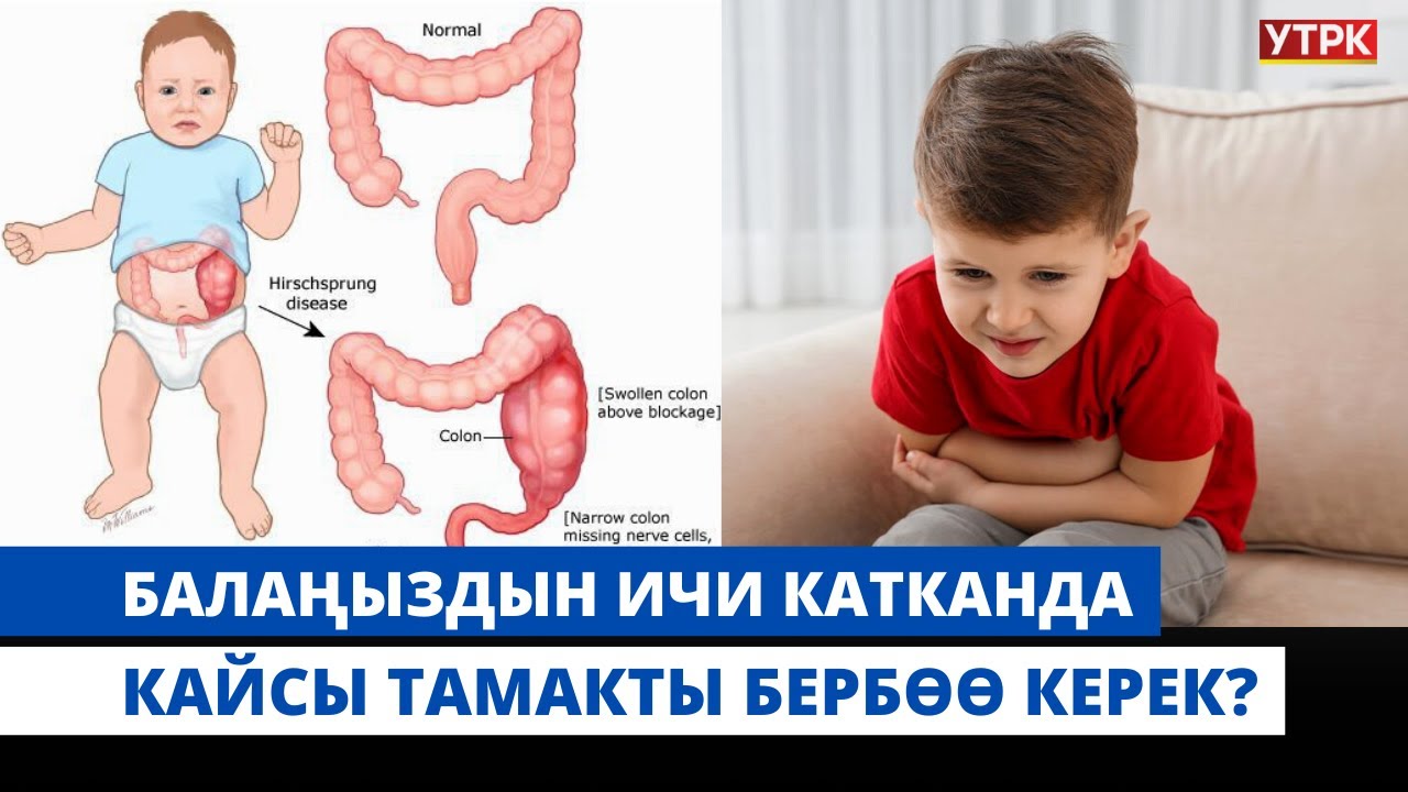 Балаңыздын ичи катканда кайсы тамакты бербөө керек? | 