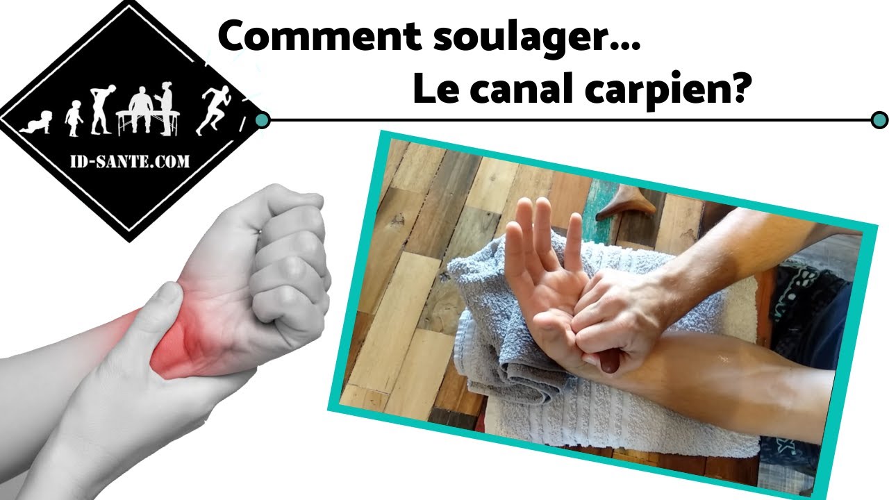 Comment soulager le canal carpien en 3 minutes par jour ?