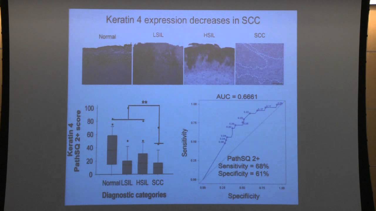 Keratin 17, a diagnostic biomarker for premalignant lesions