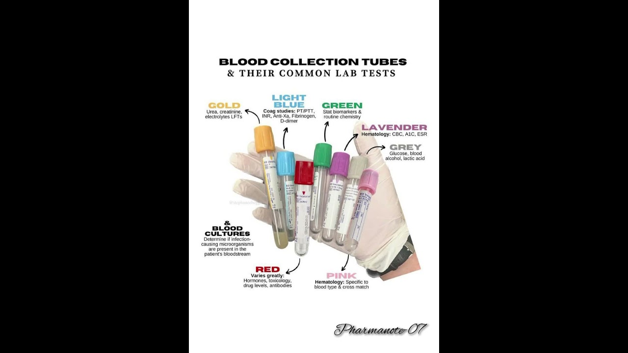 Blood collection tubes in commonly use to lab tests