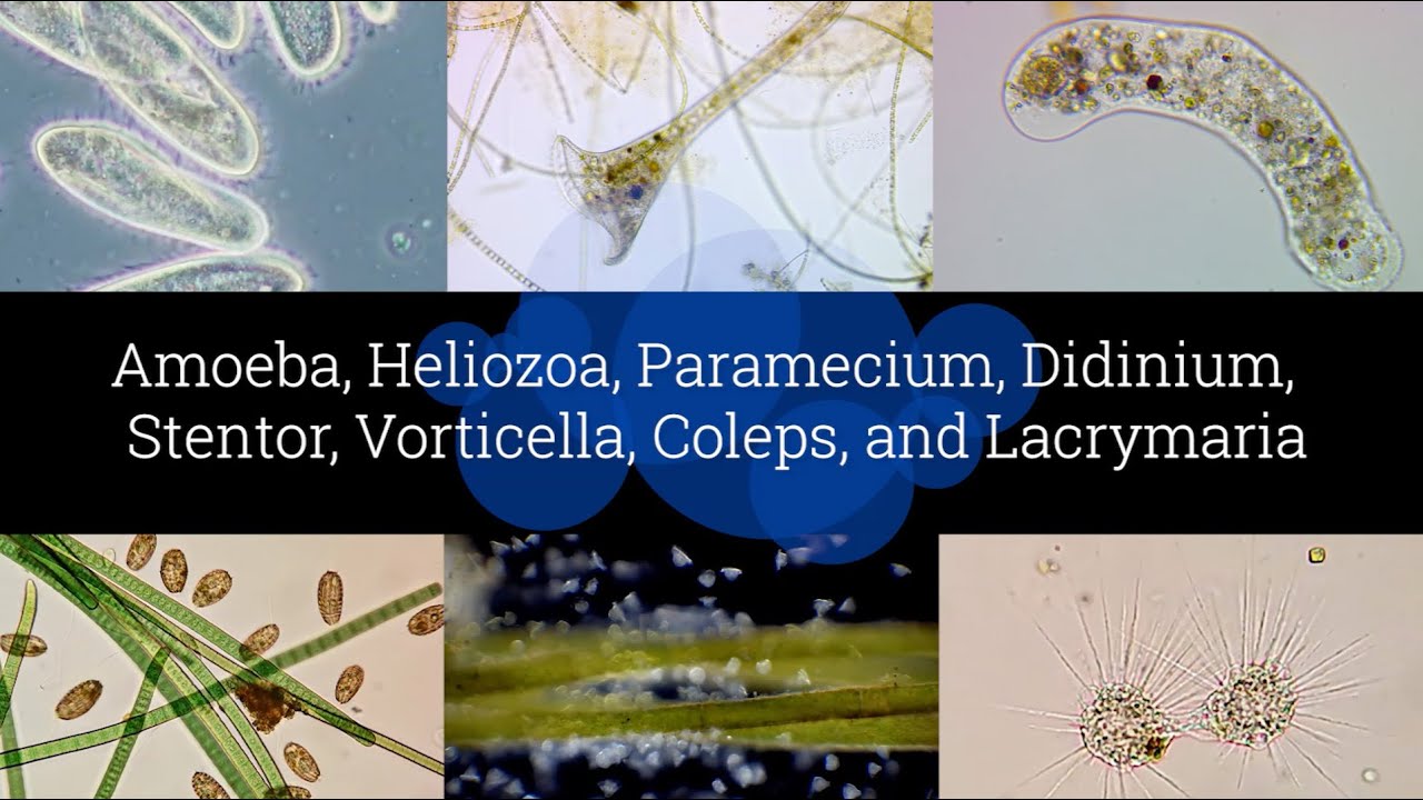 Microscopic Organisms in a Drop of Pond Water - Episode 2