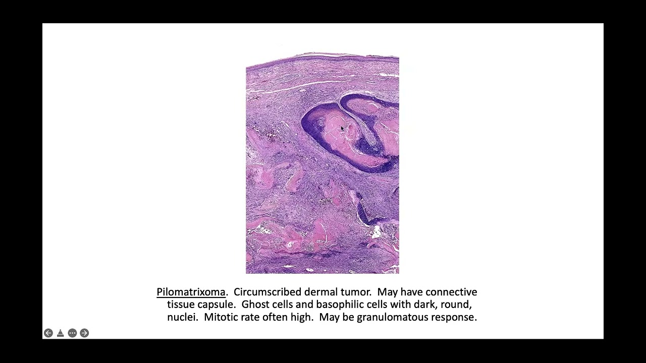 Essential dermatopathology part 1