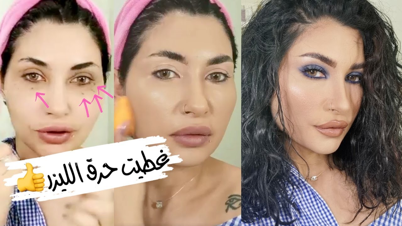 كيف غطيت حرق الليزر اللي بوجهي و عملت شعري كيرلي بالموس 🤓