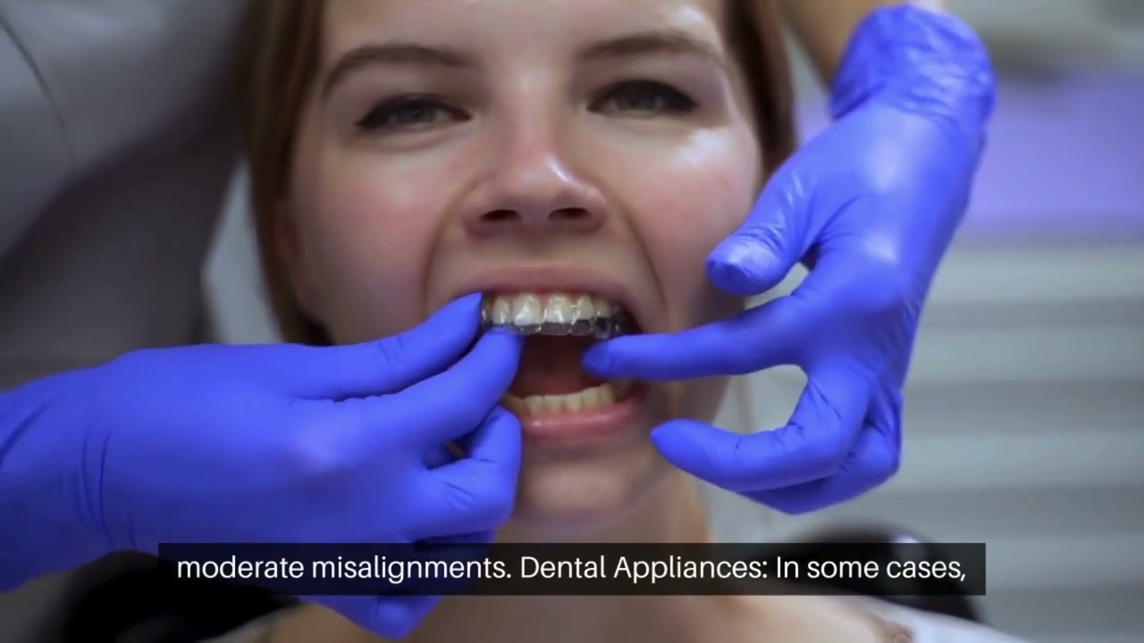 Unlock Your Perfect Smile: The Ultimate Guide to Straightening Irregular Teeth