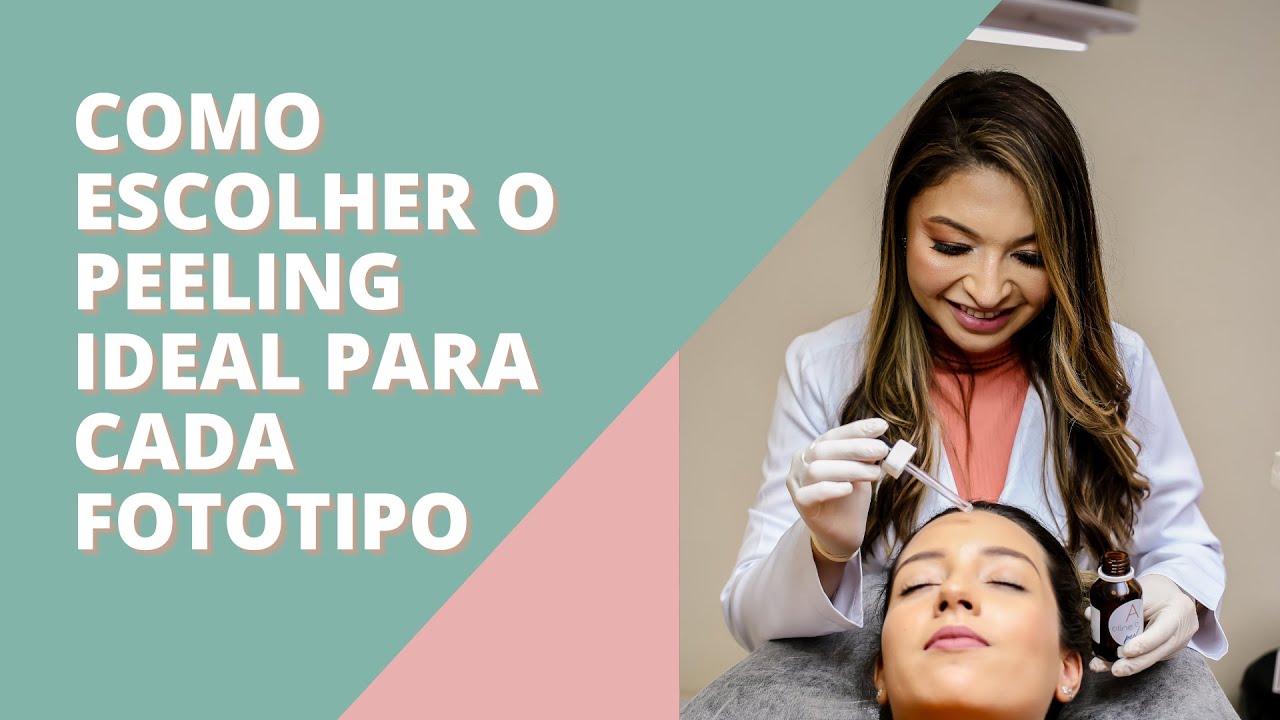 Aula 03 - Como escolher o peeling ideal para cada fototipo ( IMERSÃO DE PEELING)