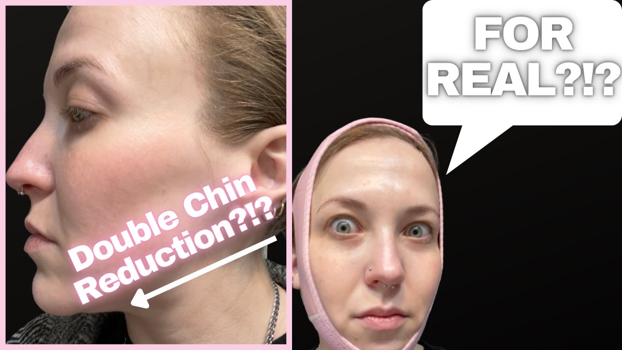 Double Chin Reducer/V-Line Lifting Strap | WILL IT WORK?! #shorts #beauty