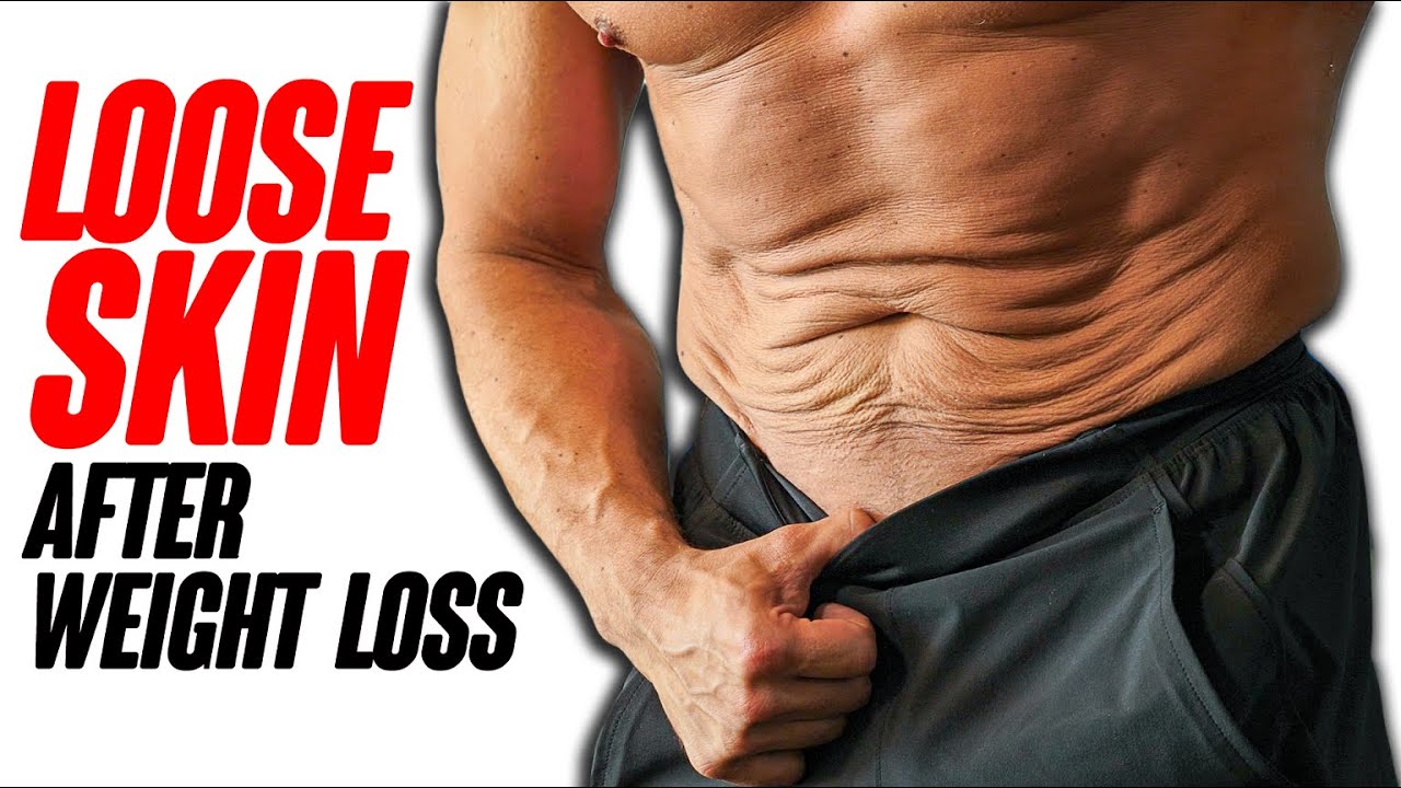 Dealing with LOOSE Skin After Weight Loss ft  Bodybuilder Lee Hayward