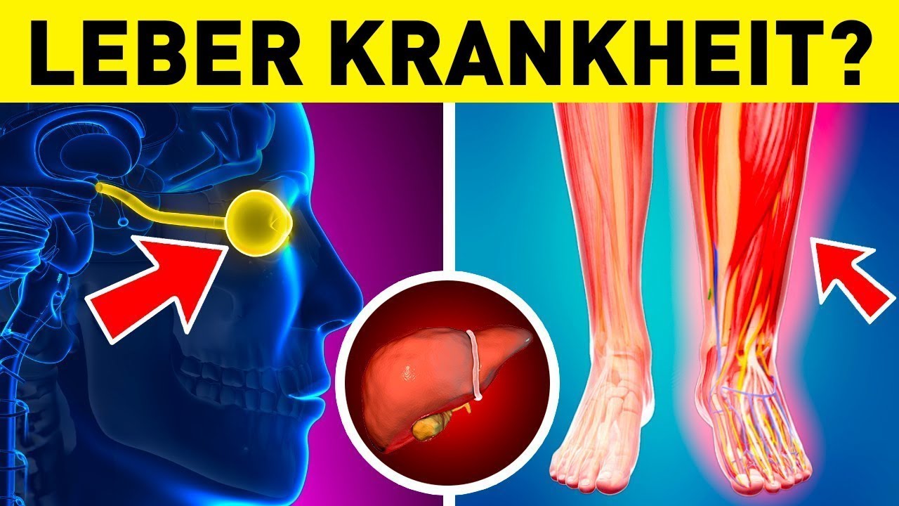 Die 10 häufigsten Frühwarnzeichen einer Lebererkrankung
