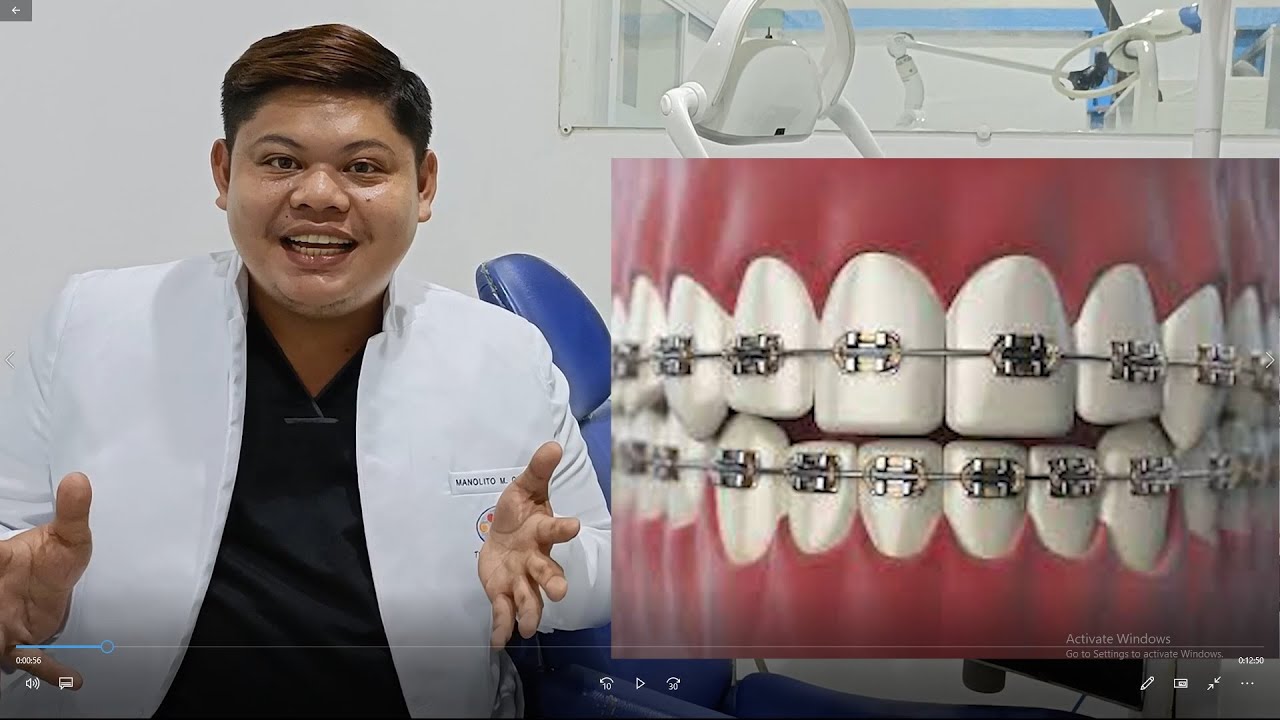 USAPANG BRACES (episode 1) | Doc Noy