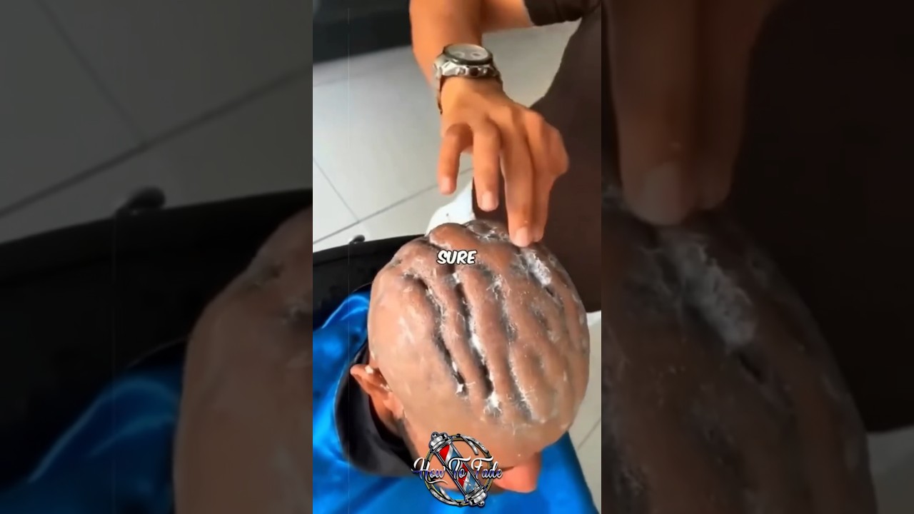 Doctor Reacts to A Rare Skin Condition!! 🤯🤯