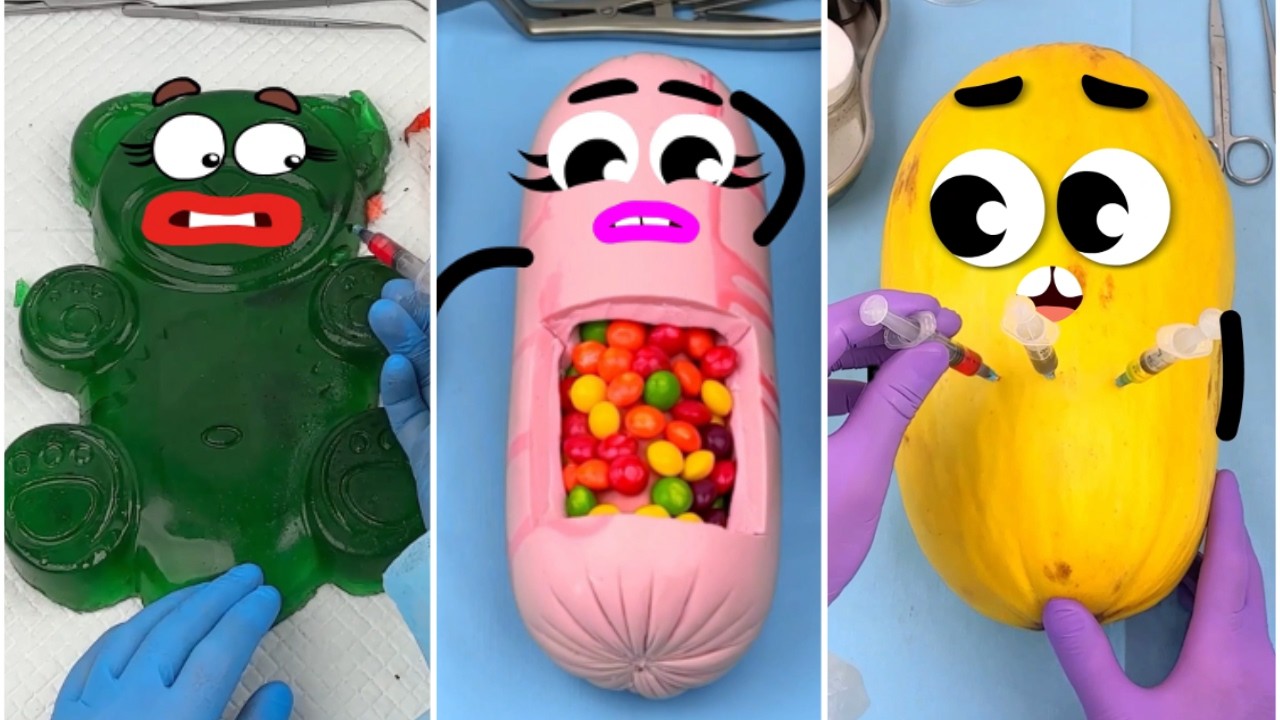 #16 I Tried Food Surgery for 30 Days Here's What Happened