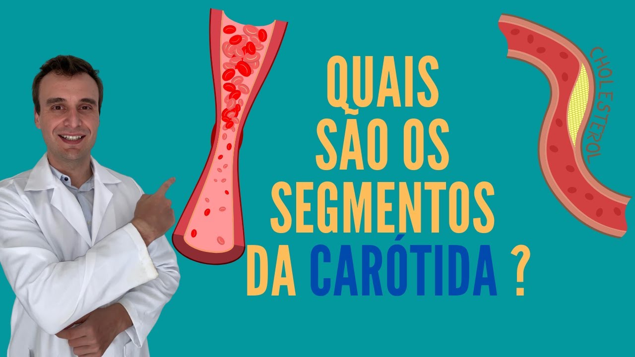 Quais s&atilde;o os segmentos da art&eacute;ria car&oacute;tida na angiotomografia? Radiologia e vascular na tomografia!