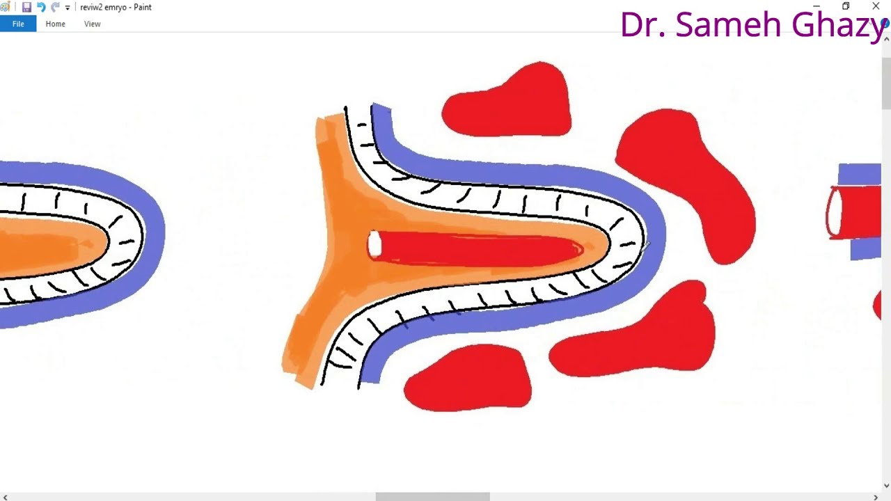 systemic pathology 65 : female genital system 6  ( tumors of placenta  )الأورام المشيمية