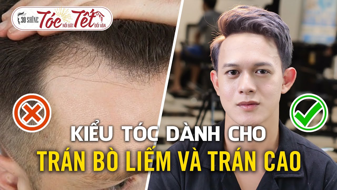 Trán Hói - Bò Liếm Thì Để Tóc Gì | 4 Kiểu Tóc Dành Cho Người Bị Bò Liếm Và Trán Hói
