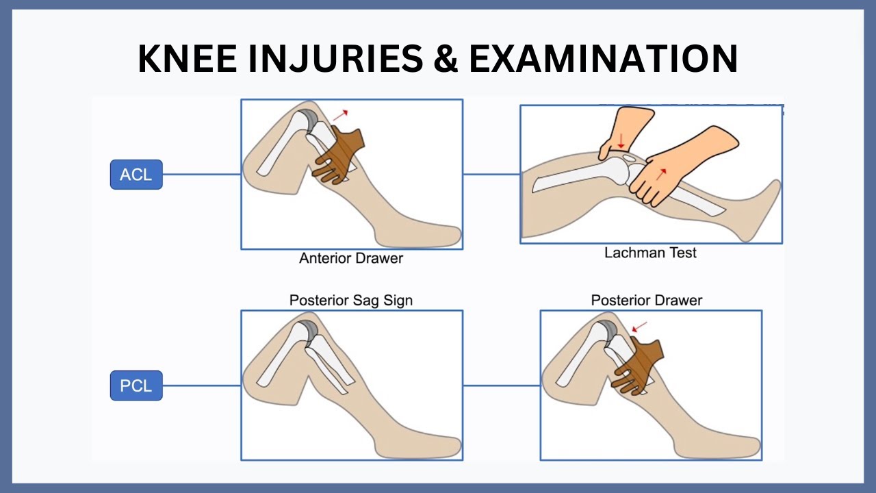 Knee Injuries and Examination Explained