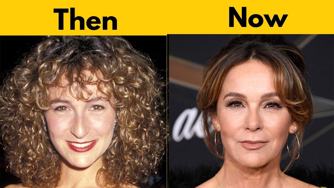 20 Famous Actresses  Of Hollywood’s Changing Face Surgery Trends Over Time(Then & Now)