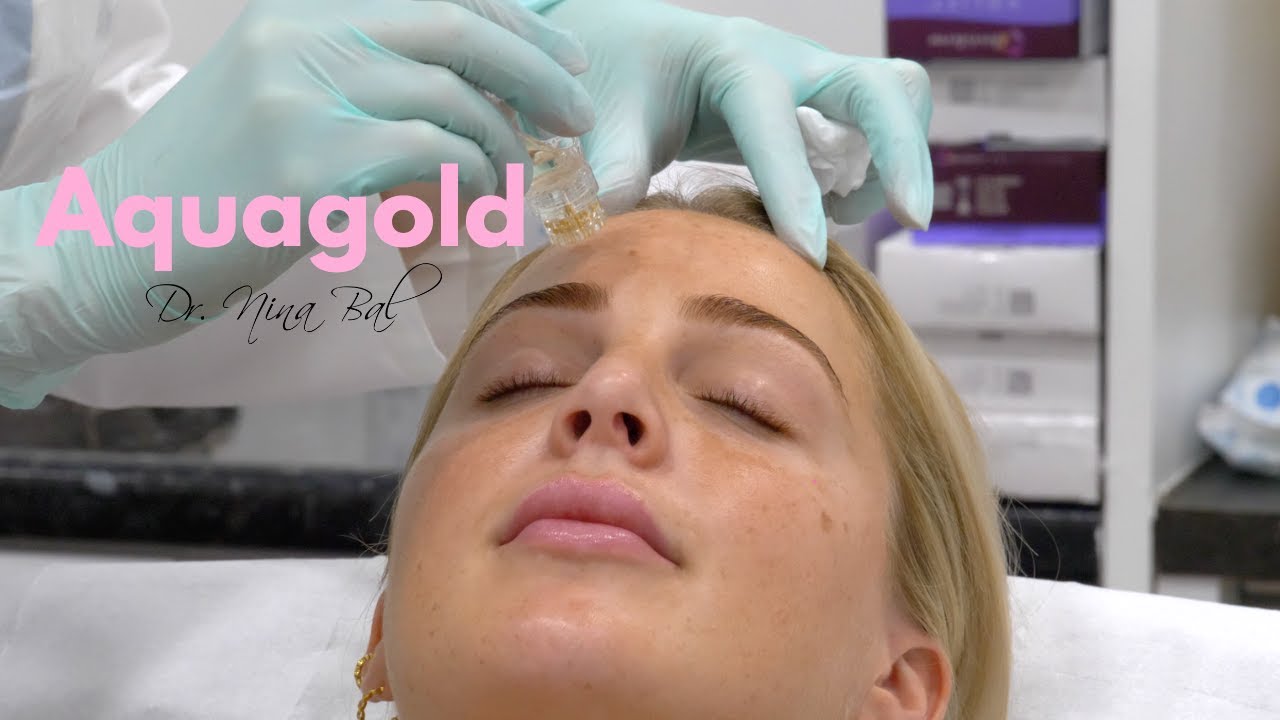 Aqua Gold Facial Before and After with Chloe ✨ Dr. Nina Bal Facial Sculpting