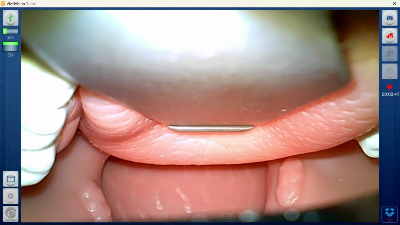Laerdal Airway Management Trainer with Airway Videos