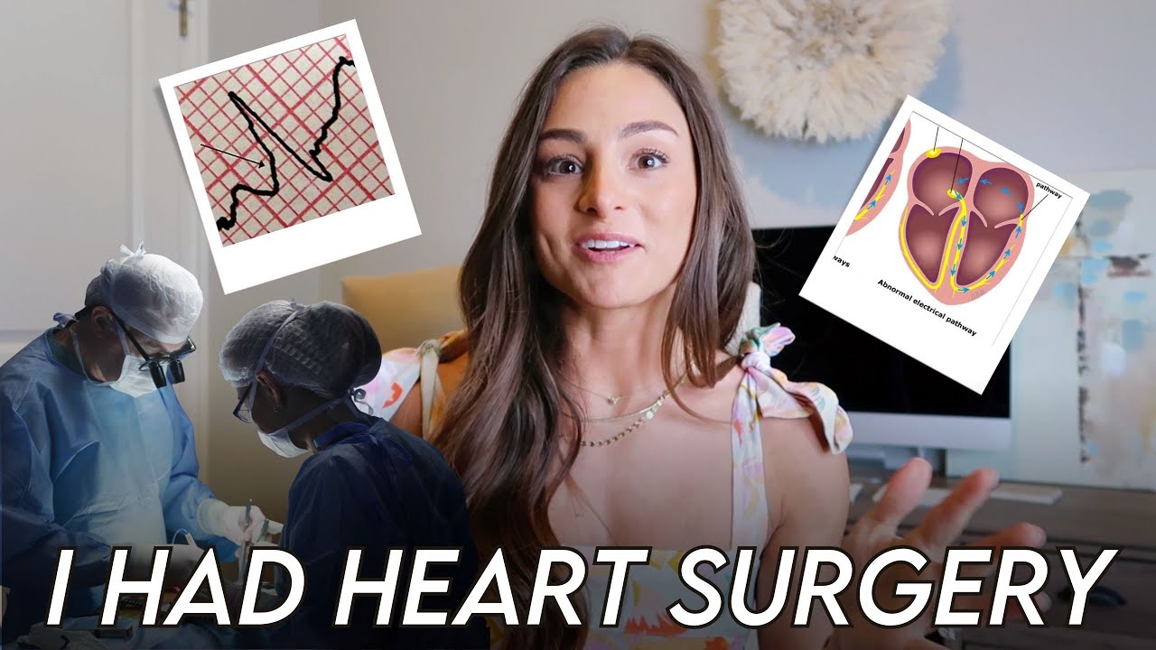 I Had Heart Surgery | Wolff- Parkinson White Syndrome