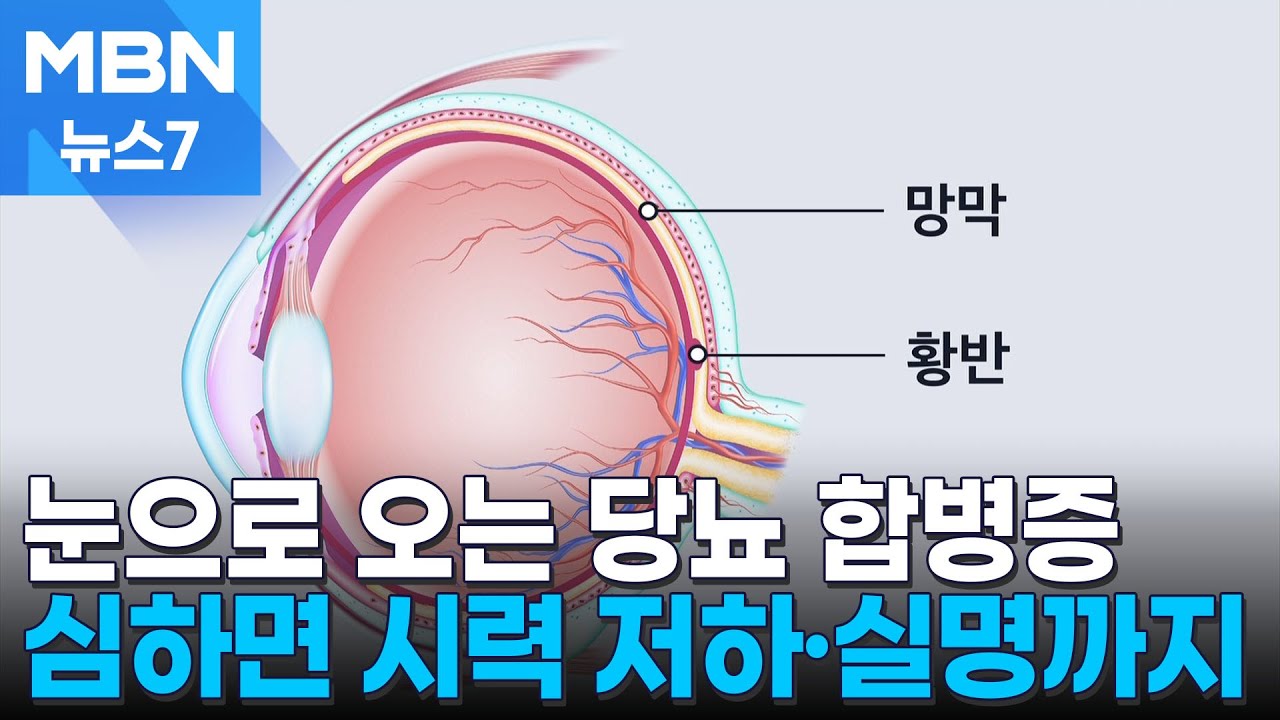 단순 노안인가 했는데&hellip;눈으로 오는 당뇨 합병증 