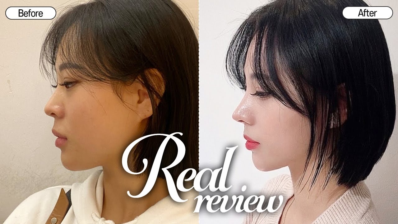 눈코 성형으로 에스파 윈터처럼된 사람 제니? 