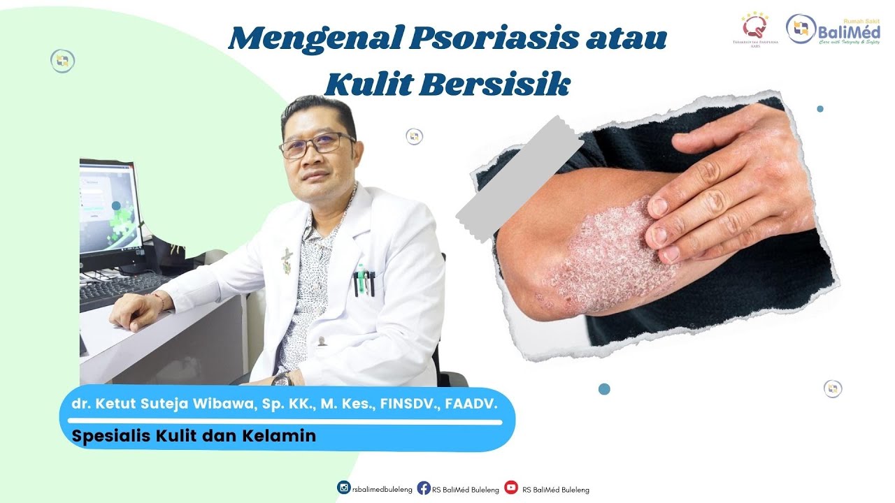 Psoriasis? Penyakit kulit yang perlu banyak orang tahu.
