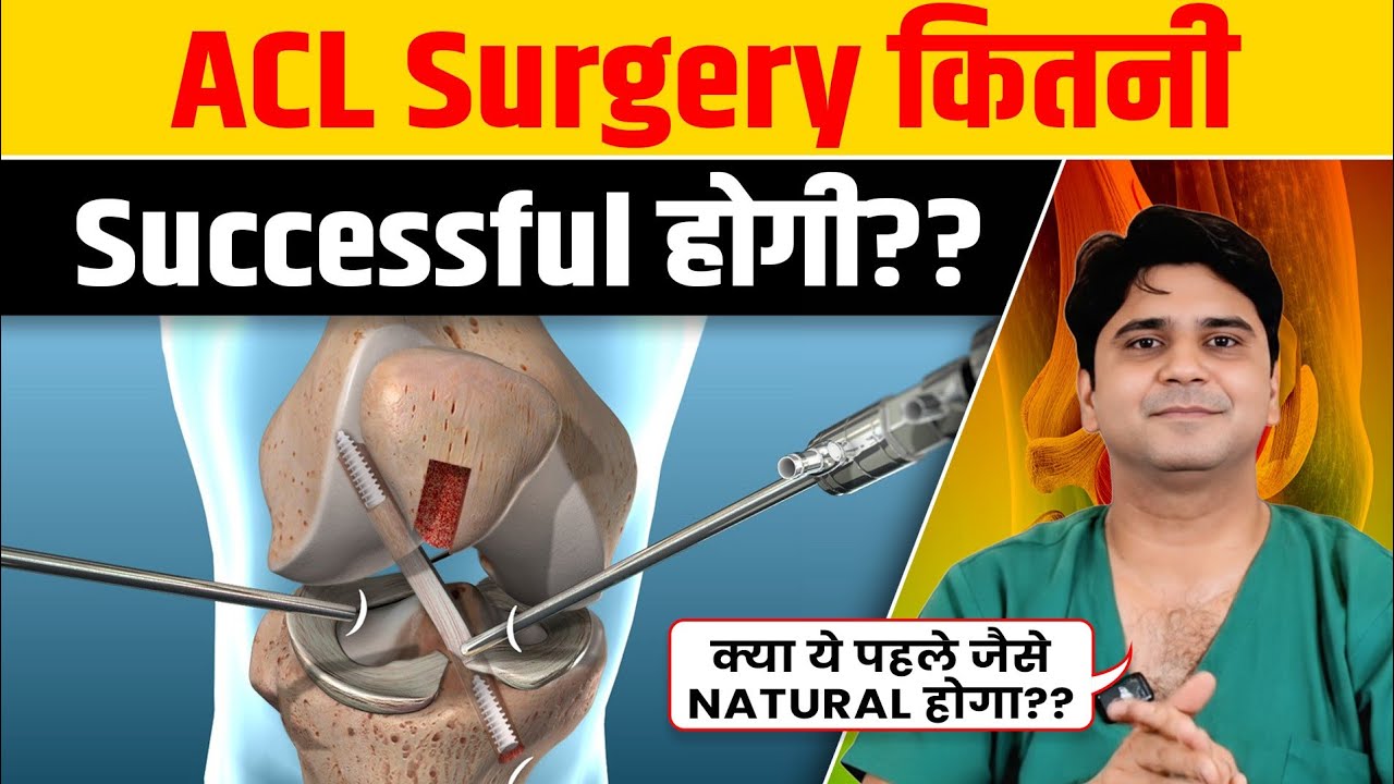 ACL Surgery कितनी Successful होती हैं? | क्या पहले जैसे Natural होगा?, कितने दिन चलेगा?? | Dr Neeraj