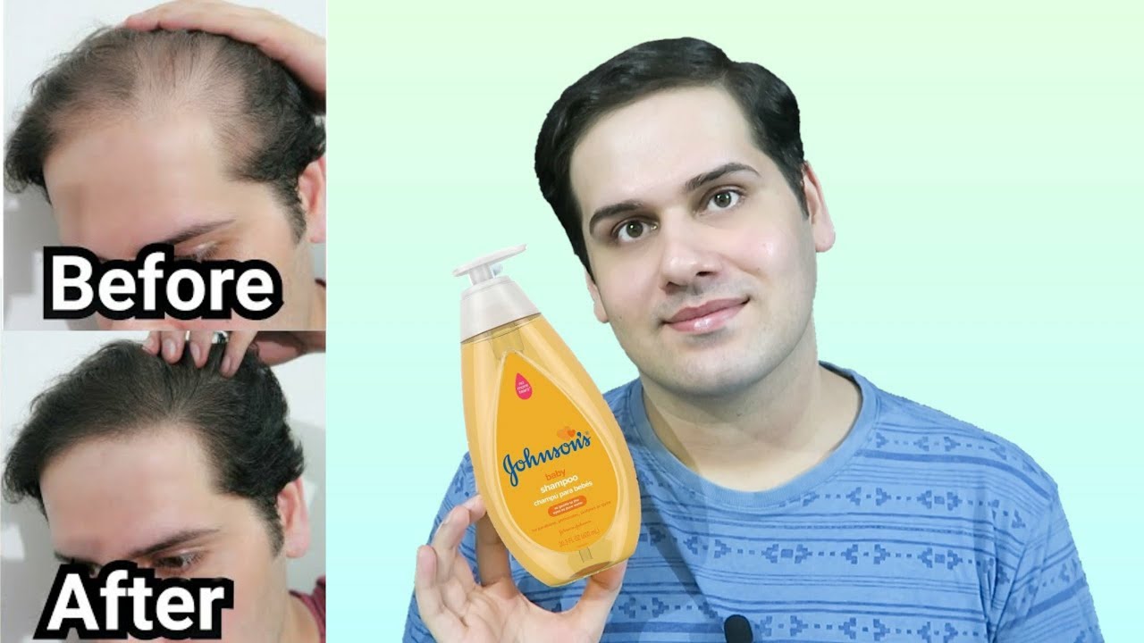 I tried Baby Shampoo for a year