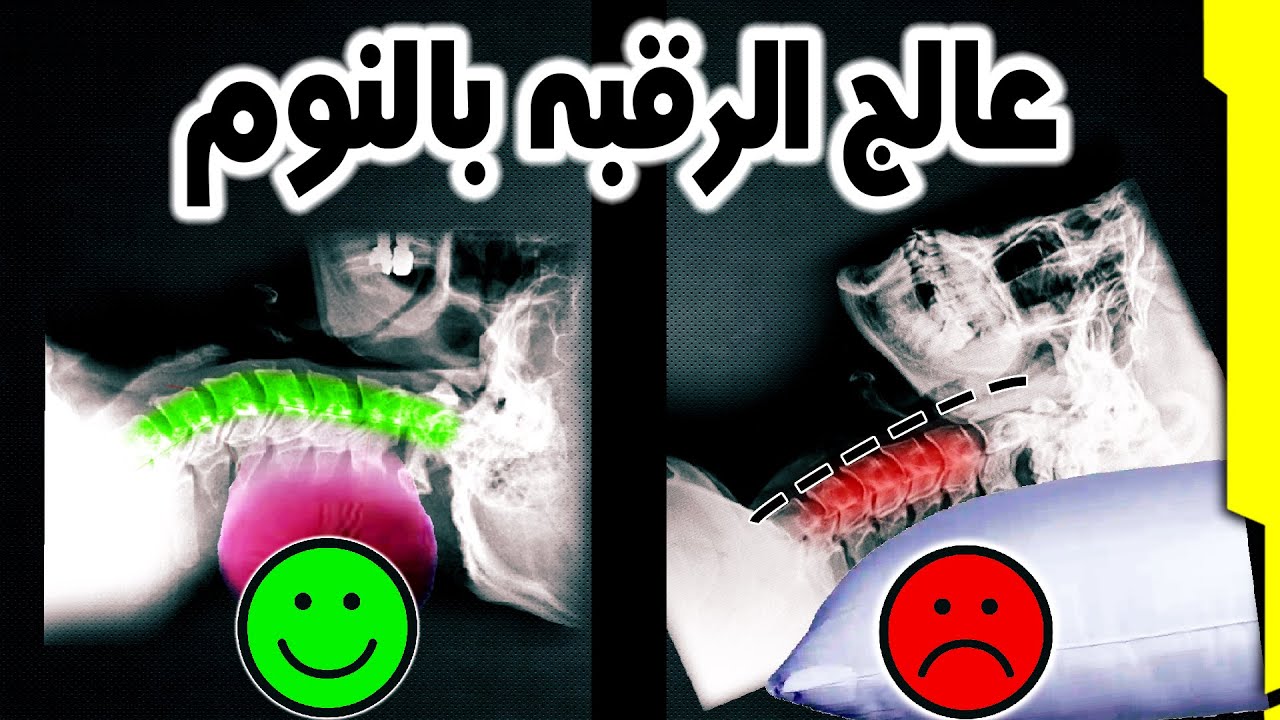 مخده علاج ألم الرقبه واستقامه الفقرات و التشنج العضلي والصداع