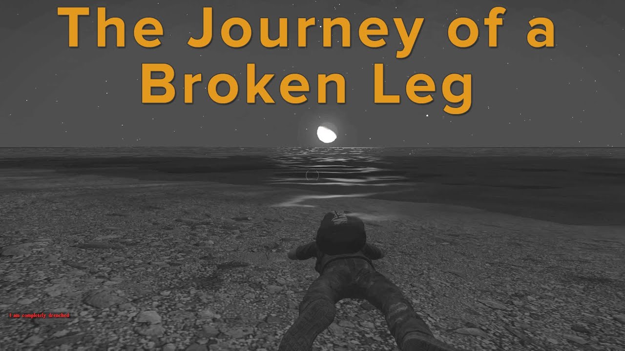 DayZ: The Journey of a Broken Leg