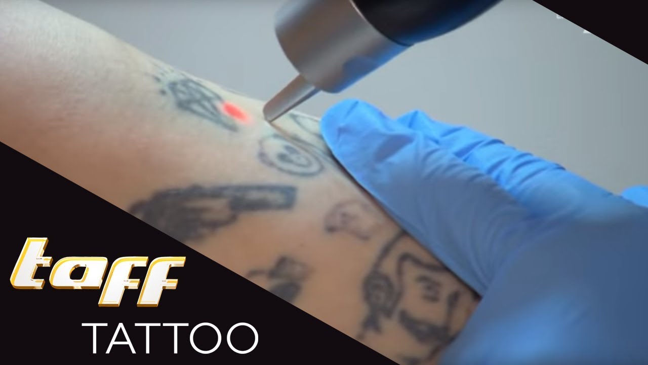 COVER-UP WEGLASERN LASSEN – Weg mit den Horrortattoos | taff Tattoo | ProSieben